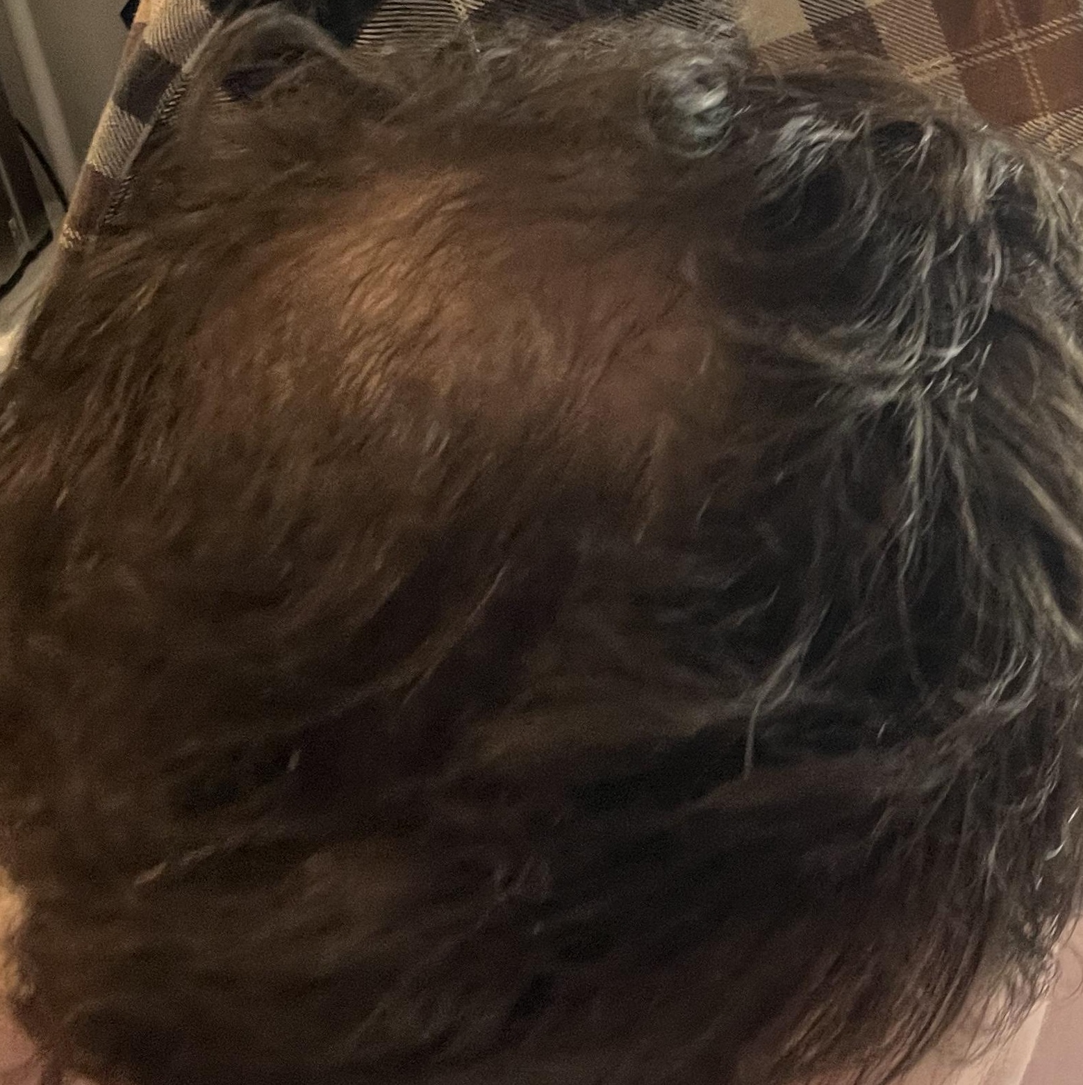 Verlaufsfoto des Haarwirbels vom 21. Juni 2026 während meines iRestore Professional Tests