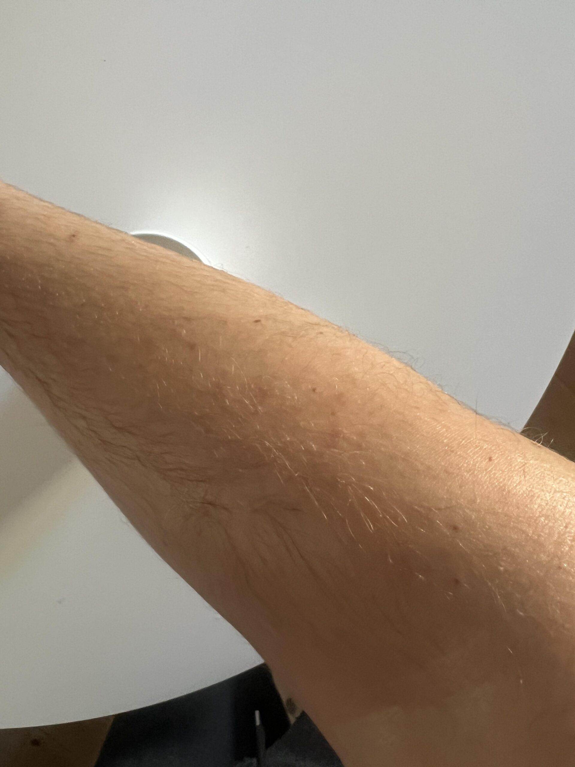 My arm after applying Mixa cream
