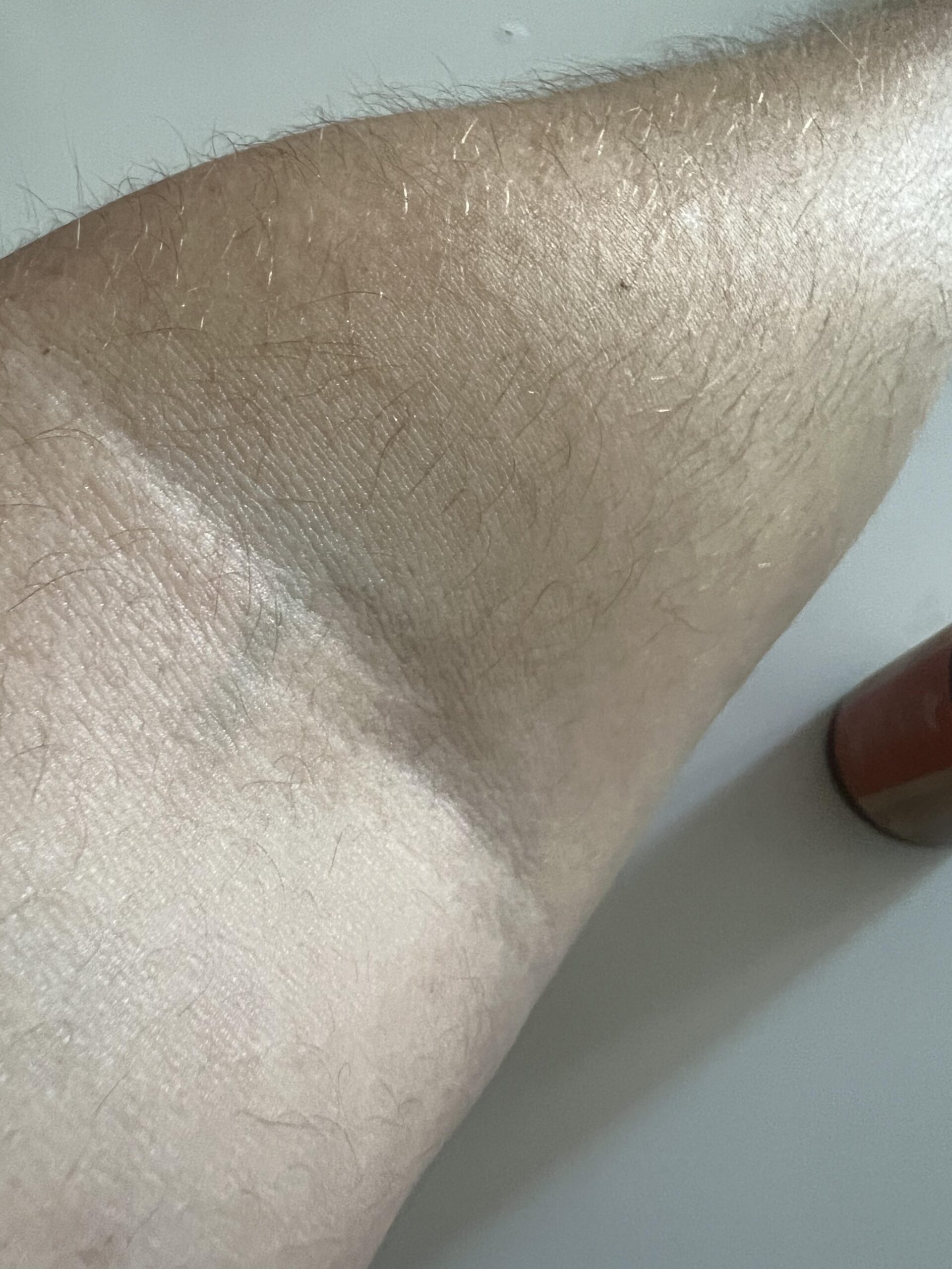 Close-up of my forearm after spreading Soena Naturals Vitamin C Serum